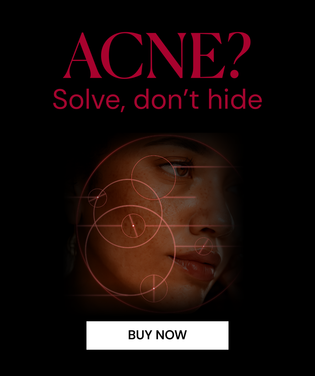 ACNE EXPERT - ODA PRO