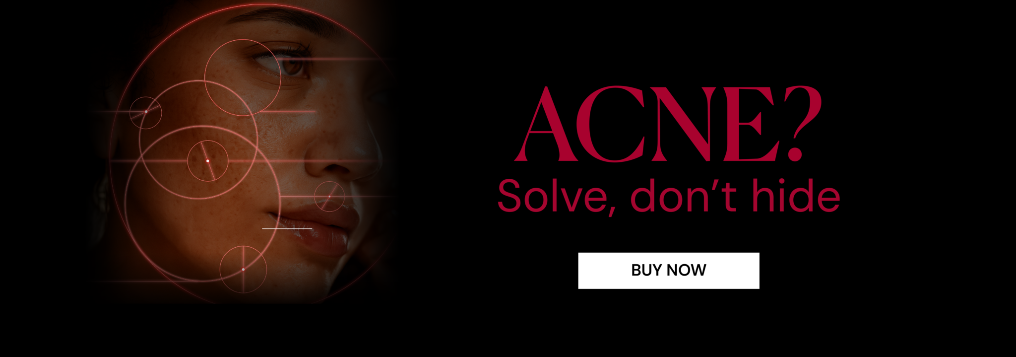 ACNE EXPERT - ODA PRO