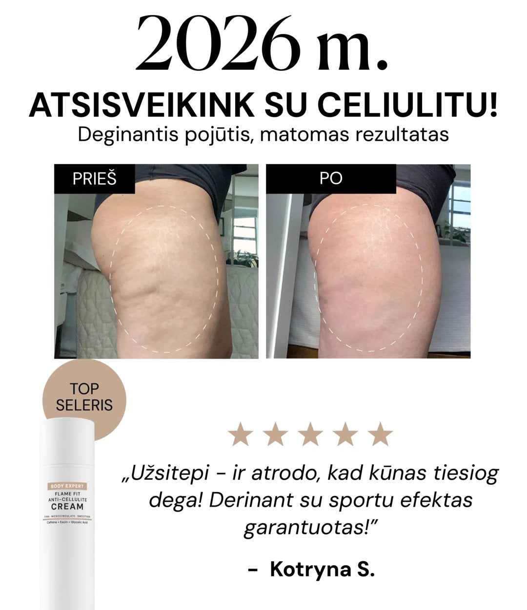 Kotryna: prieš ir po, atsiliepimas