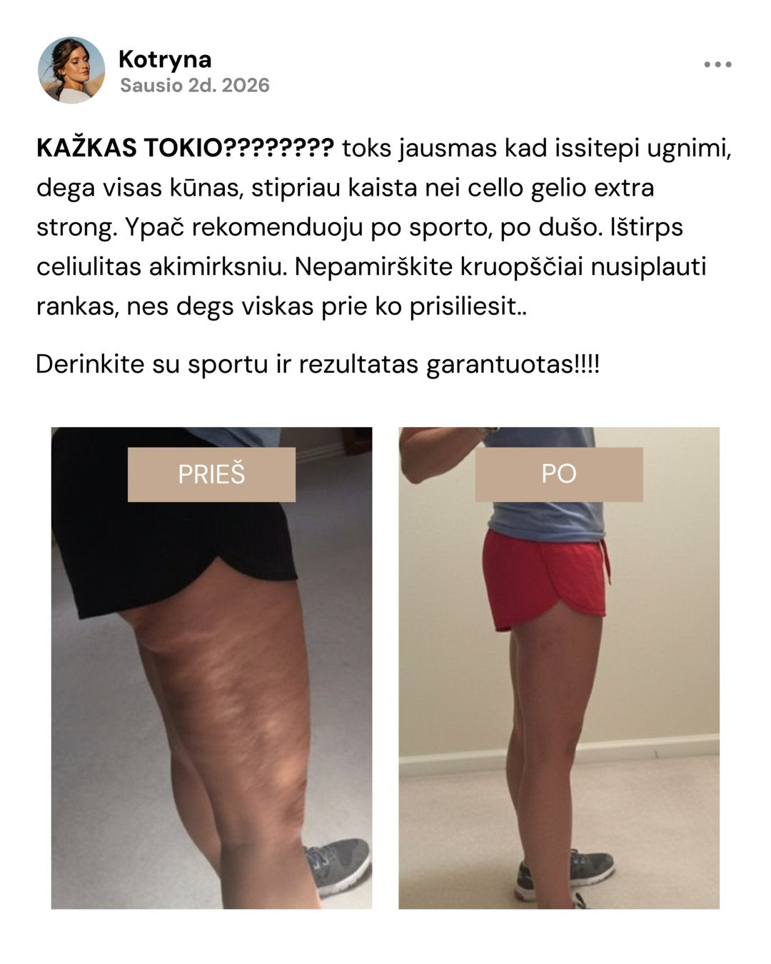 Kotrynos atsiliepimas su prieš ir po nuotraukomis