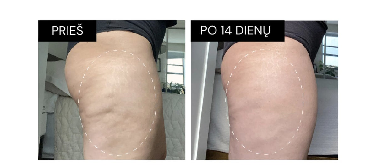 Prieš ir po 14 dienų