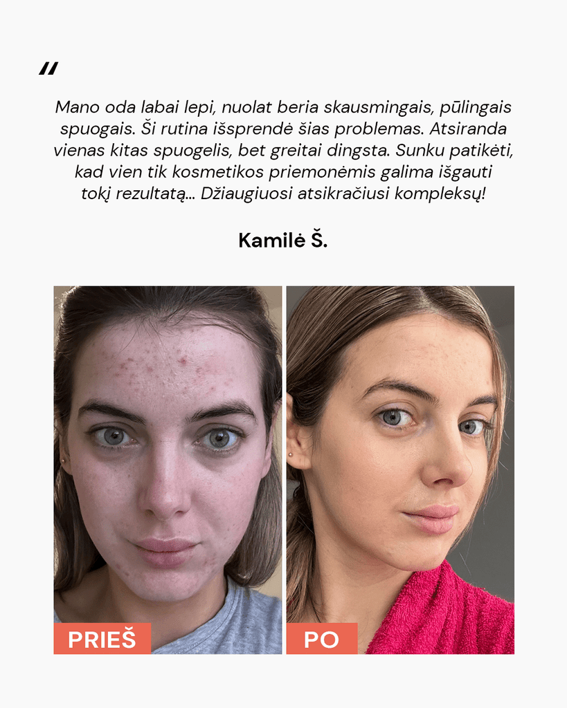 RUTINA MIŠRIAI IR Į BĖRIMUS LINKUSIAI ODAI - ODA PRO